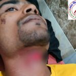 साली की शादी में जीजा ने किया हंगामा ! पत्नी को साथ ले जाने की जिद में युवक ने गला रेत कर खुद को किया घायल !